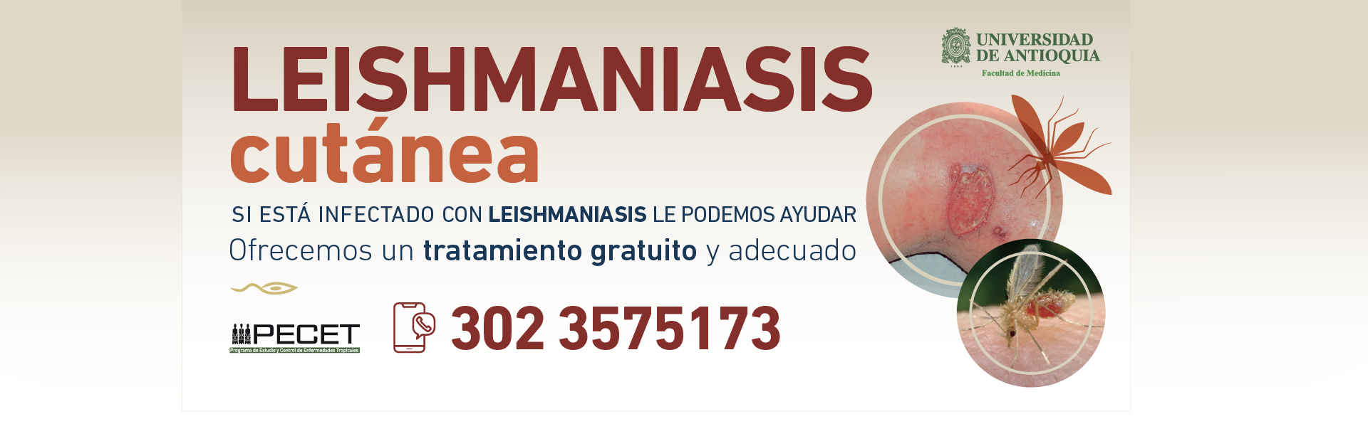Estudio clínico Leishmaniasis